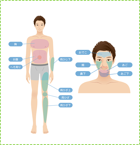 男性の脱毛部位